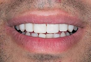 Dennis J. Hong DDS, Family   Cosmetic Dentistry | Crowns  amp  Caps, Periodontal Treatment and Veneers