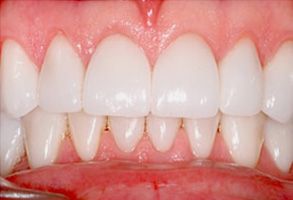 Dennis J. Hong DDS, Family   Cosmetic Dentistry | Periodontal Treatment, Implant Dentistry and Dentures