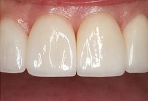 Dennis J. Hong DDS, Family   Cosmetic Dentistry | Dental Bridges, Pediatric Dentistry and Emergency Treatment