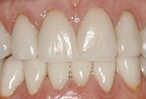 Dennis J. Hong DDS, Family   Cosmetic Dentistry | Teeth Whitening, Implant Dentistry and Dentures