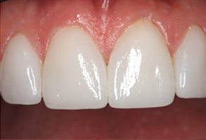 Dennis J. Hong DDS, Family   Cosmetic Dentistry | Teeth Whitening, Dental Cleanings and Periodontal Treatment