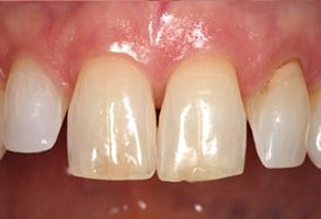 Dennis J. Hong DDS, Family   Cosmetic Dentistry | Periodontal Treatment, Implant Dentistry and Dental Cleanings