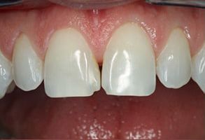 Dennis J. Hong DDS, Family   Cosmetic Dentistry | Pediatric Dentistry, Implant Dentistry and Dental Fillings